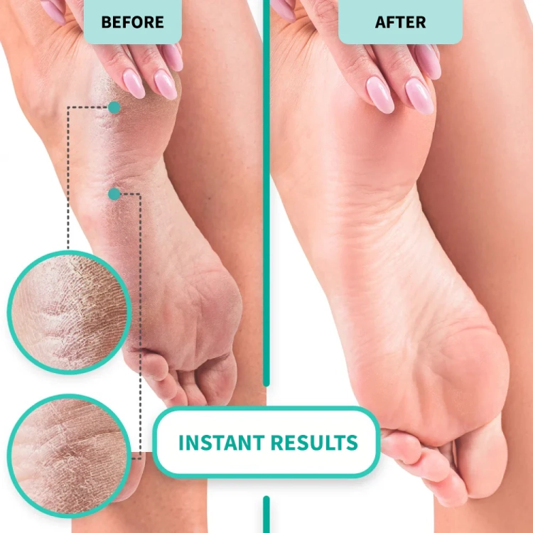 kąpiel do manicure shelly, preparat do pedicure spa, zmiękczanie skórek, soft blade spa bath, profesjonalny pedicure, przygotowanie skóry do stylizacji