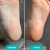 Foam_express_softener_for_pedicure_Soft_blade.jpg.webp