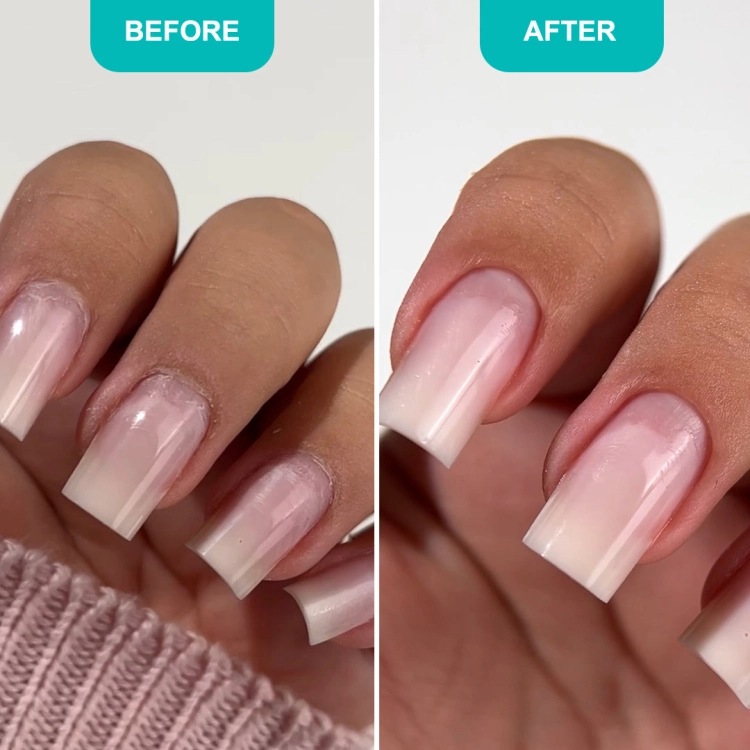 Shelly Preparat do usuwania skórek Soft Blade 30 ml — efekt przed i po